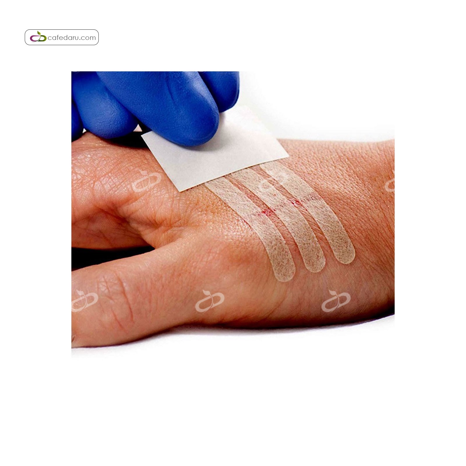 چسب بخیه فارما استریپ 6/4 در 76 میلی متری